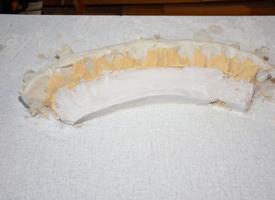 Fehlende Krone herstellen